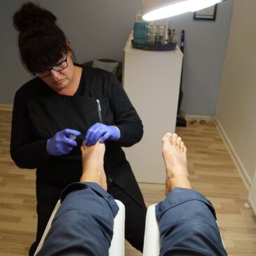 Alm. fodbehandling i klinik 310,-